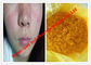 Polveri steroidi crude/isotretinoina per i Cancri di pelle, CAS 4759-48-2 di colore giallo fornitore